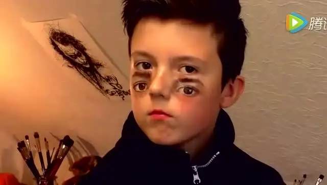 小男孩突然长出四只"眼睛",家人居然发笑