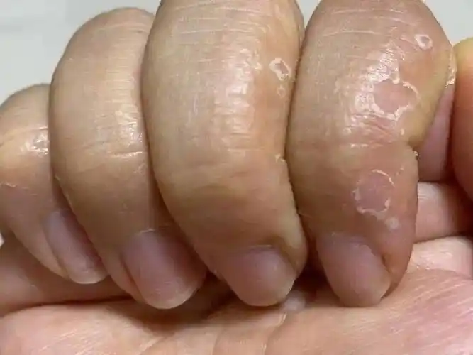 警惕最近此病高发