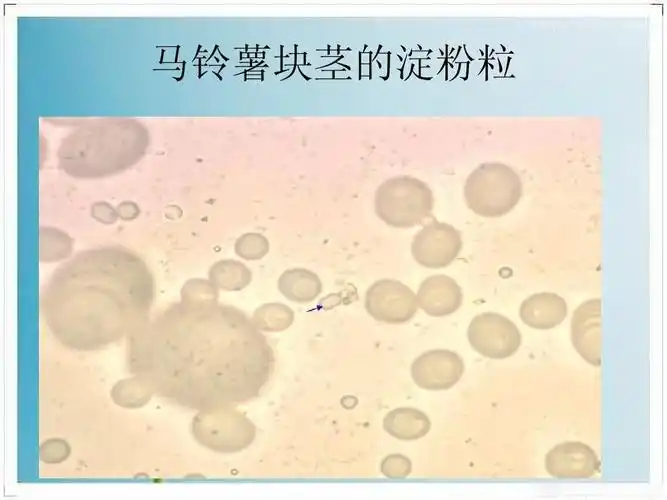 药用植物学实验复习资料 马铃薯块茎的淀粉粒