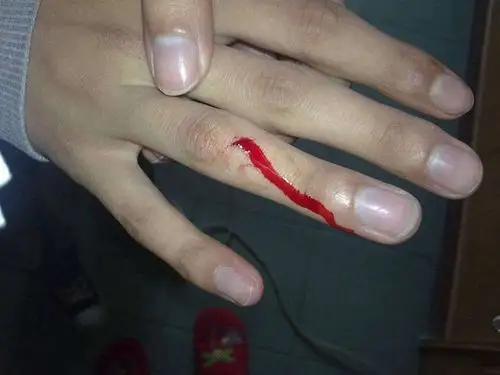 手指流血图片52