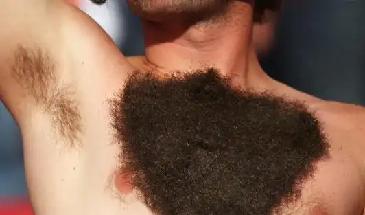 一般会随着龄增长逐渐减少,这个是正常现象,基本上是青春期开始长