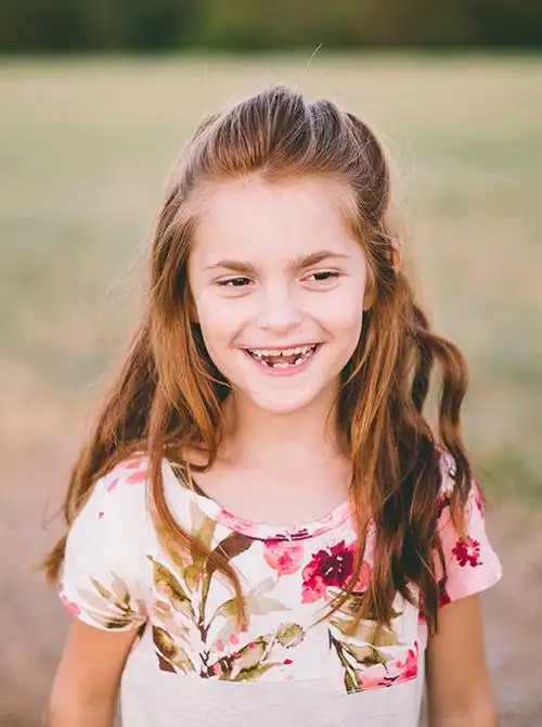 angelman综合征(天使综合征):症状和体征,病因,流行病学,诊断与治疗