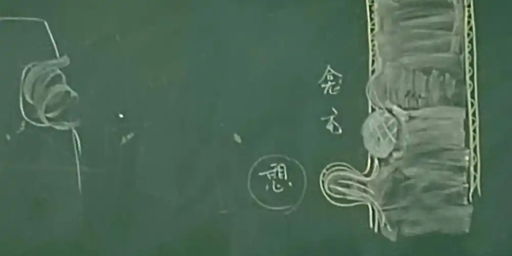 胃肠道轮廓改变1龛影钡剂造影时,钡剂进入消化道管壁上深浅,大小不一