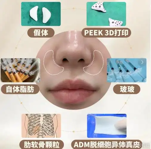 鼻基底填充##假体隆鼻##鼻子##韩国哪家医院做鼻子做的最好