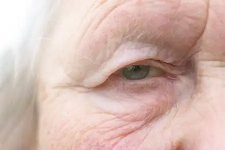 眼睛在画面中央.瞳孔有柔和的焦点,视力差的概念,一切都是模糊的照片