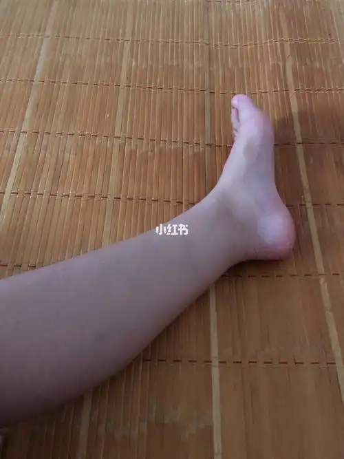 没有脚踝的苦恼怎么办救救孩子吧