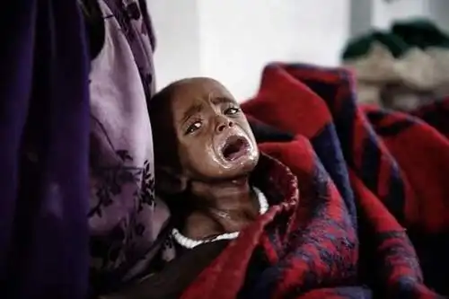 直击:非洲那些骨瘦如柴的孩子们,直刺人心!