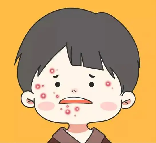 男生们长痘痘怎么办?教你三步解决