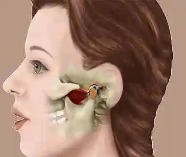 嚼东西耳朵旁边骨头痛 颞下颌关节:张嘴吃东西咯噔一声,耳朵前面就疼