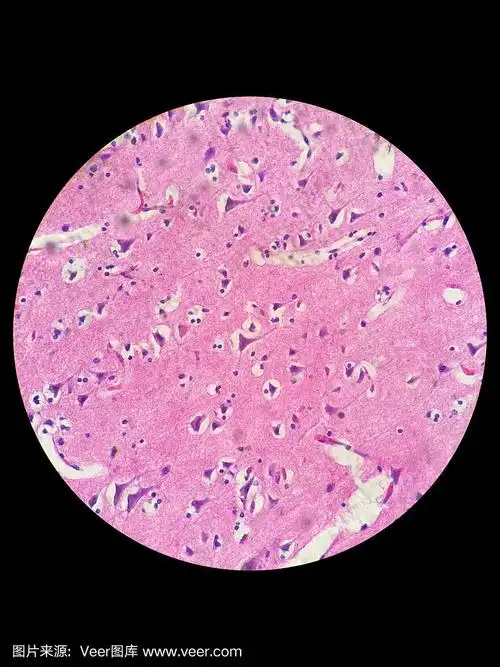 光镜下的神经细胞