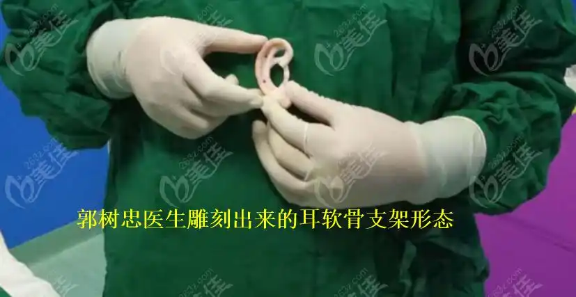 郭树忠医生雕刻出来的耳软骨支架形态