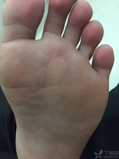 丁香园论坛 - 专业医生社区,医学,药学,生命科学,科研学术交流