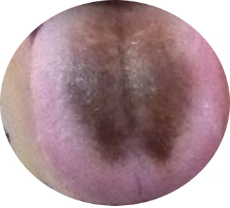 胃病都是怎么来的得了胃病我们该注意些什么