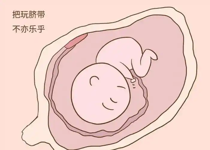 胎儿脐带绕颈怎么办