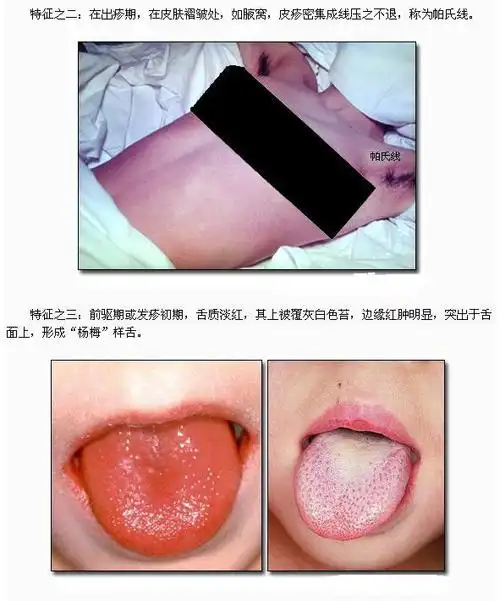 【2016年临床执业医师儿科学考试辅导之小儿生长发育规律考点汇总】