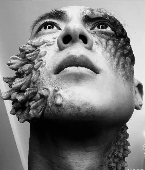 密集物恐惧症_密集物恐惧症图片