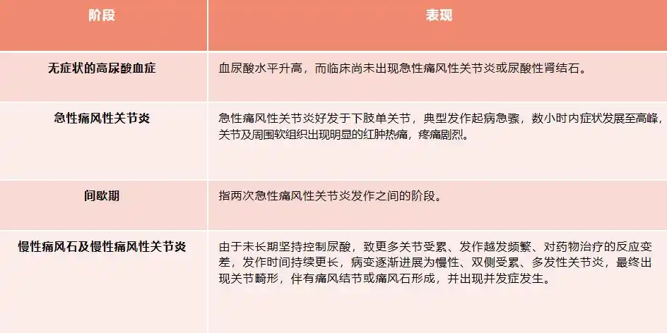 痛风发展的四个阶段