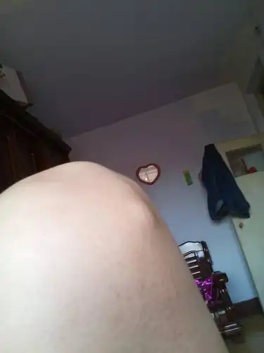 膝盖骨上有一个鼓包,好像是骨头,这是右腿,而左腿没有,这是怎么回事