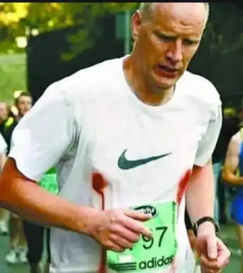 为何男性跑马拉松都用"胸贴",血的教训太惨痛,不用的都后悔了