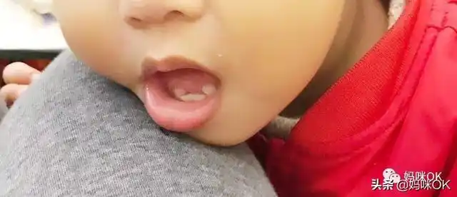 宝宝乳牙被蛀了怎么办宝宝乳牙被虫蛀了怎么办