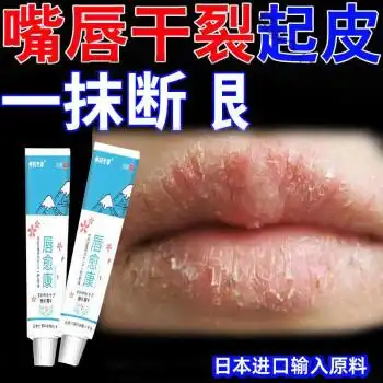 唇l炎膏润唇膏嘴唇干裂唇周炎过敏性口角炎脱皮红肿瘙痒保湿修复膏一