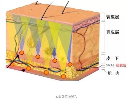 在施术过程中要有效避过面部神经危险区域,同时兼顾smas筋膜层的有效