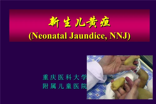 [医疗保健]新生儿黄疸_11387.ppt
