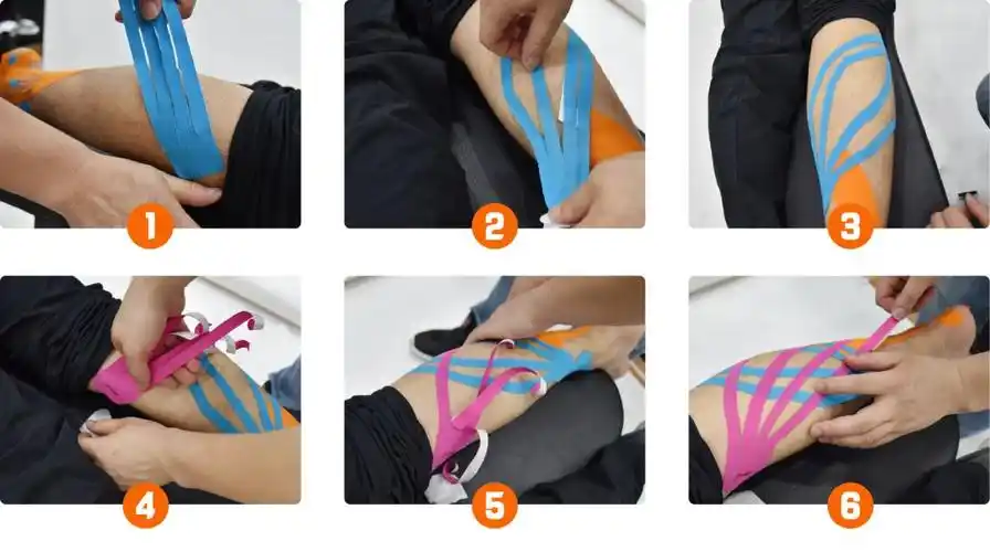 放松大腿内外侧贴法:大腿内外侧紧绷疼痛,是很多跑者常见的问题,这个