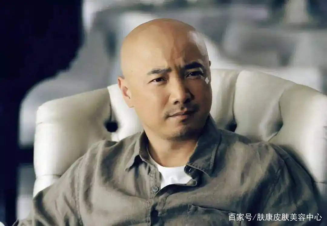 娱乐圈内脱发的男星,葛优徐峥在列其中,还有两位70后!