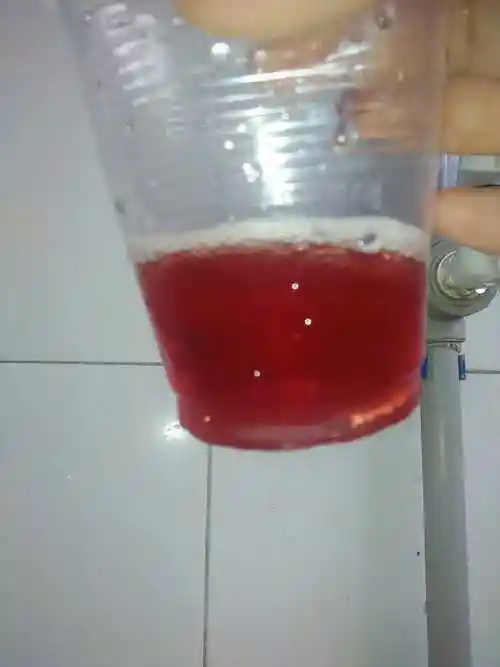 小便茶叶色怎么回事(小便颜色茶叶色是什么原因)