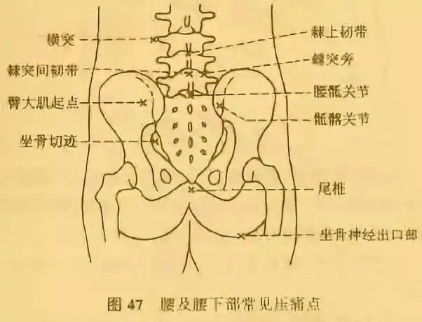 同时,含胸,驼背,压力更多的集中鄙人背部,发生腰骶和骶髂区域的痛苦