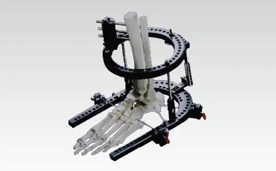 器械编号:10173-多功能透光外固定支架-医疗骨科器械|外固定支架|骨科