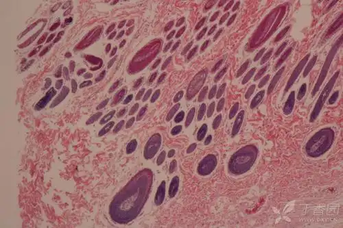 请教皮肤切片he染色附属器辨认,谢谢