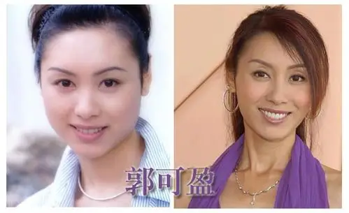 组图八卦美丽明星瘦脸前后大对比
