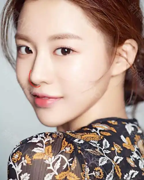 96前天的直播简单点了一下直鼻和小翘鼻,没想到小姑娘_圈子-新氧