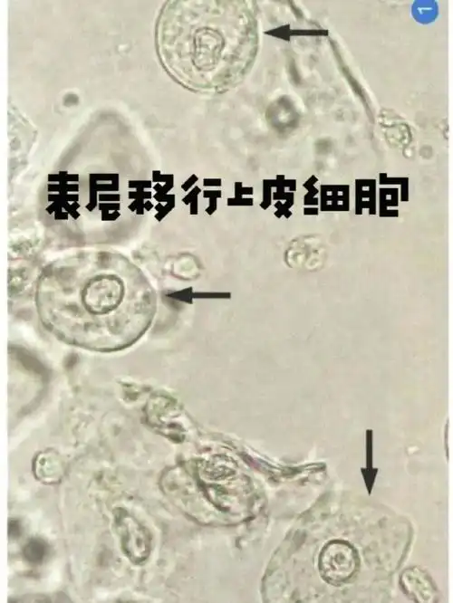上皮细胞超全高清体液图谱
