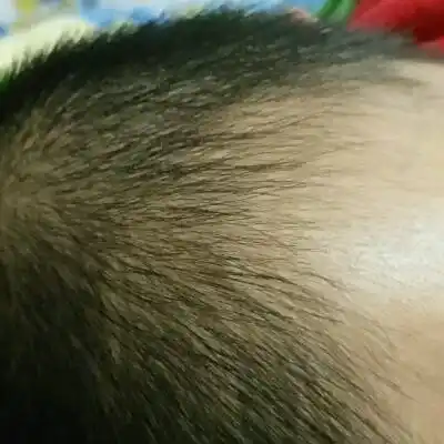 宝宝,头盖骨有一点突起,中间有一条突起