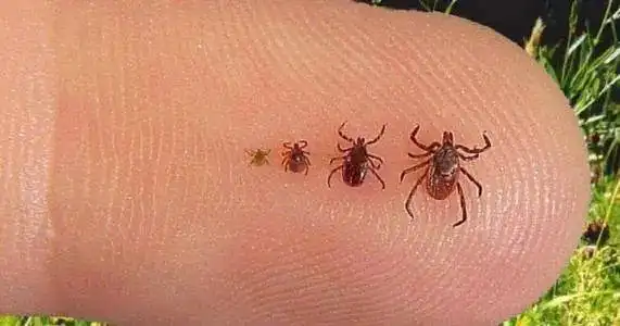 2岁小孩被蜱虫吸血多天虫子涨大几十倍取下来还活着