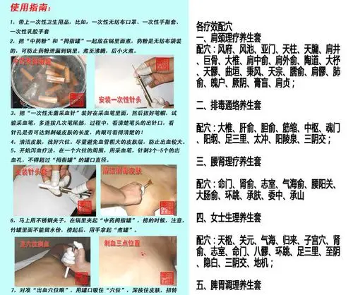 拇指罐紫竹微排水煮罐竹罐刺血罐泻血罐拔罐器真空体验装12个装