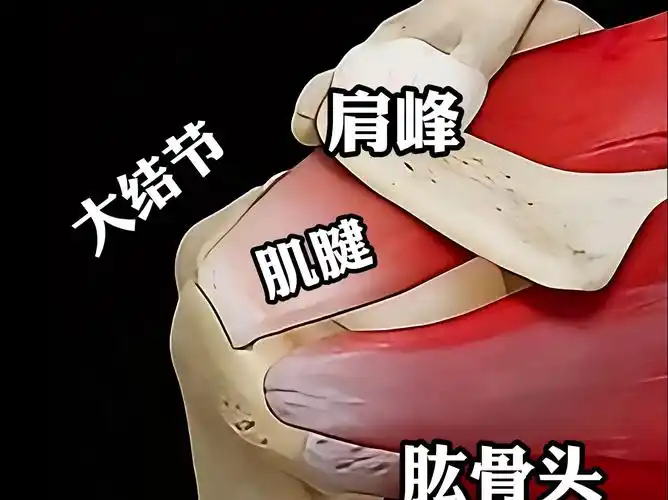 肩袖损伤是由"骨刺撞断的",画图配合3d动画给你讲解