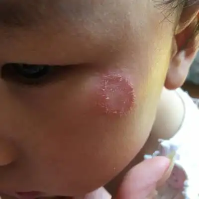 宝妈们帮忙看看小宝宝的眼角是什麼东西呢,怎麼办?谢谢