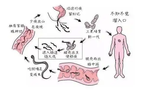 蛲虫病的传染率很高 虽然患病的大多是孩子 但成人也有可能被感染