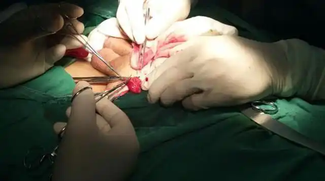 关于睾丸挫伤的图片及评论