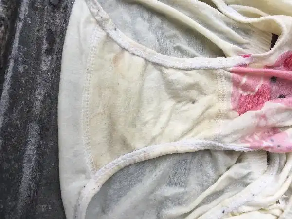 洗两岁小孩内裤时发现的,这是什么