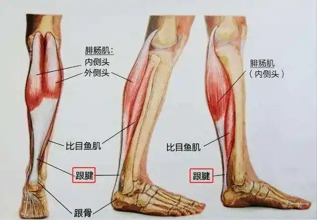 人体最强肌腱,跟腱炎怎么做康复治疗?_腾讯新闻