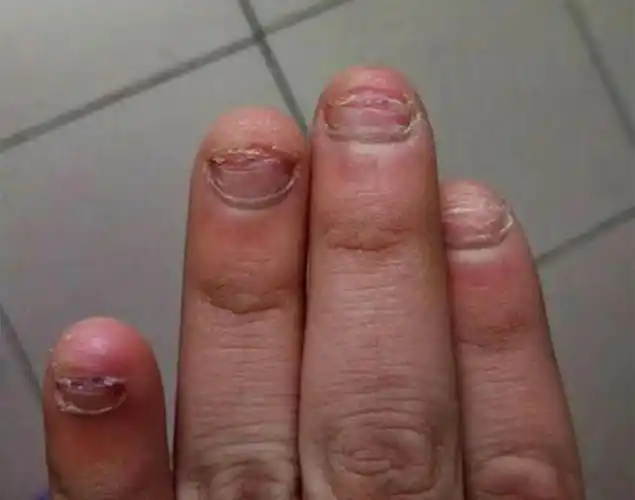 宝宝爱咬指甲是怎么回事(孩子爱啃指甲就是缺乏维生素吗) - seo葵花