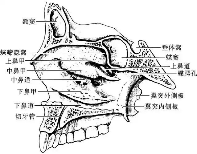 图1-16 骨性鼻腔外侧壁(右侧)3)鼻旁窦是鼻腔周围含气空腔,与鼻腔相通