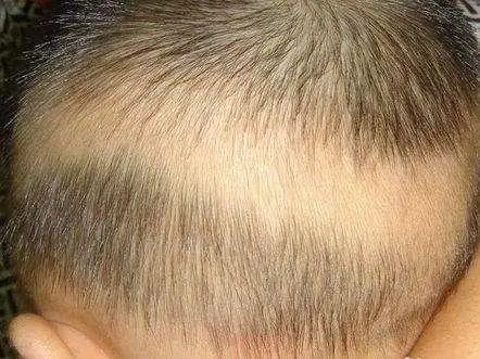 宝宝缺钙会有哪些表现?如何补钙从这4点入手?