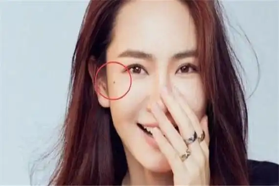 泪痣千万不能去的原因是什么眼睛附近长有泪痣不吉利