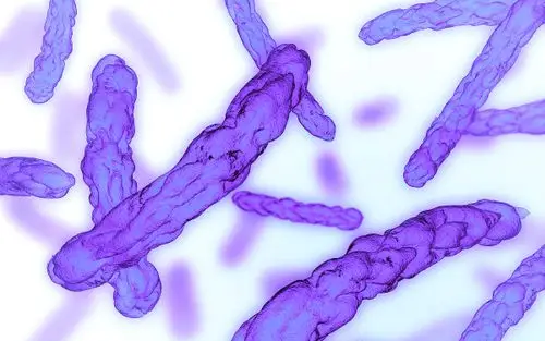 变形杆菌怎么检测